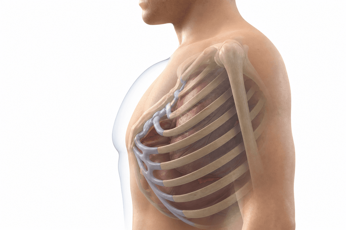 Pectus Excavatum