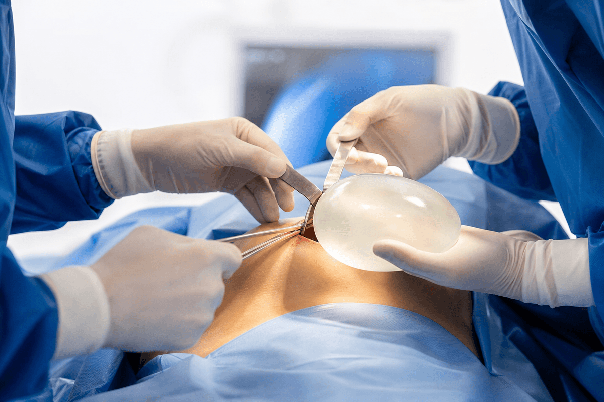 Breast Augmentation (Implants)