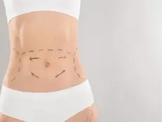 abdominoplasty-Hi-tech City