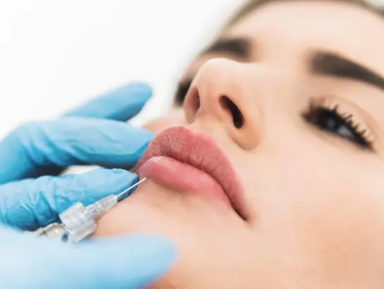 lip-surgery-treatment-near-hitechcity